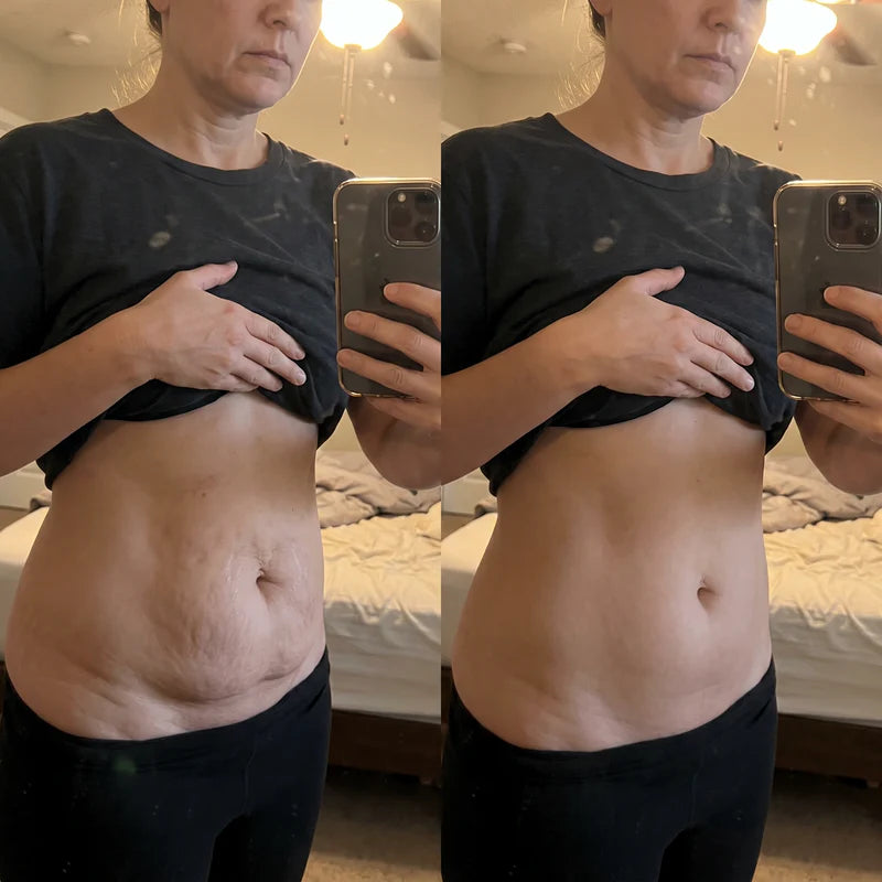 Antes y despues, Lucia, 52