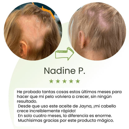 Sérum de crecimiento capilar (60 ml)