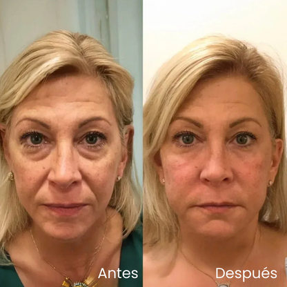 Crema contorno de ojos V-Lift