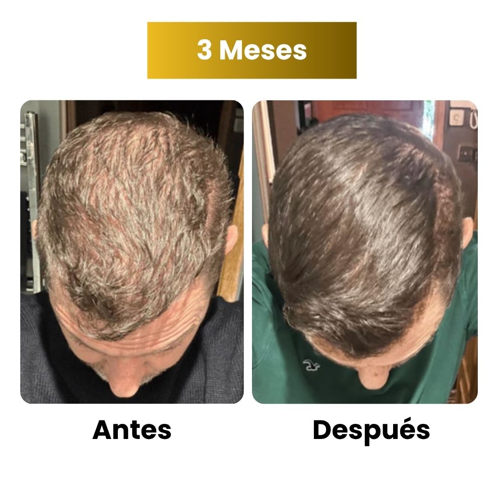 Sérum de crecimiento capilar para hombre (60 ml)