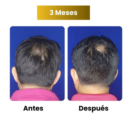 Sérum de crecimiento capilar para hombre (60 ml)