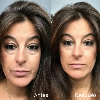 Crema contorno de ojos V-Lift