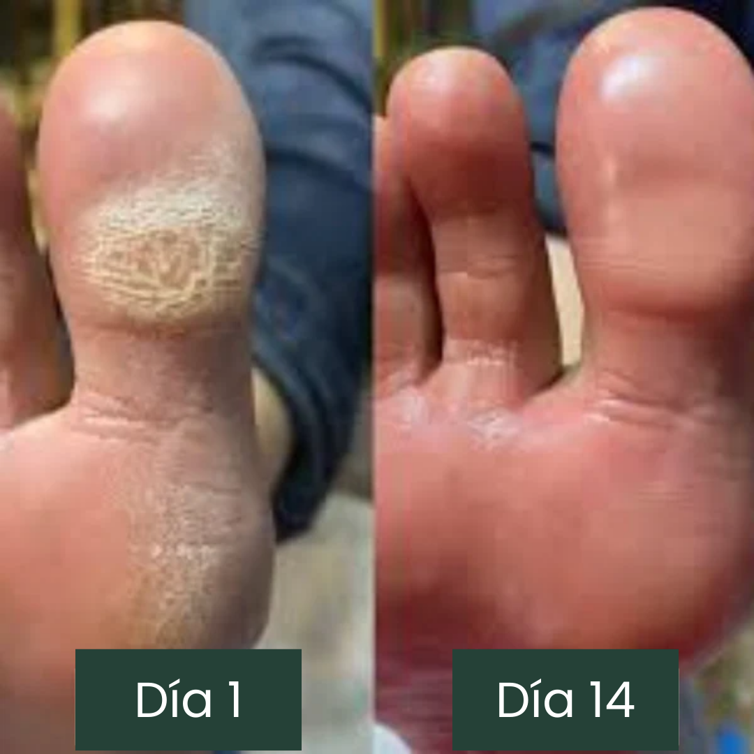 Jabón anti-hongos Jayna