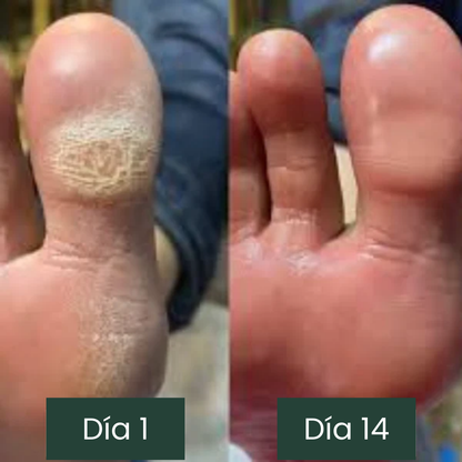 Jabón anti-hongos Jayna