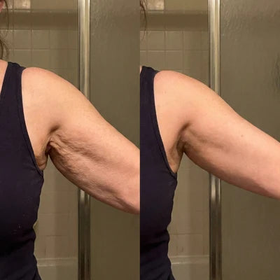 Antes y despues, Ana, 49