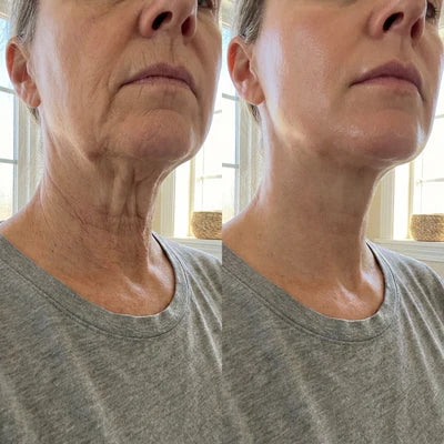 Antes y despues, Carmen, 58