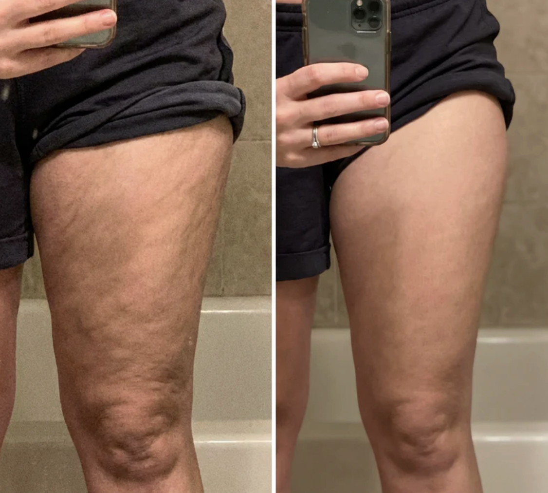 Antes y despues